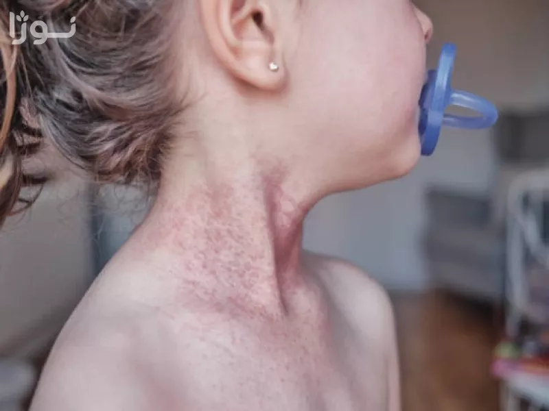 تصاویر وبلاگ خدمات نوژا سرویس