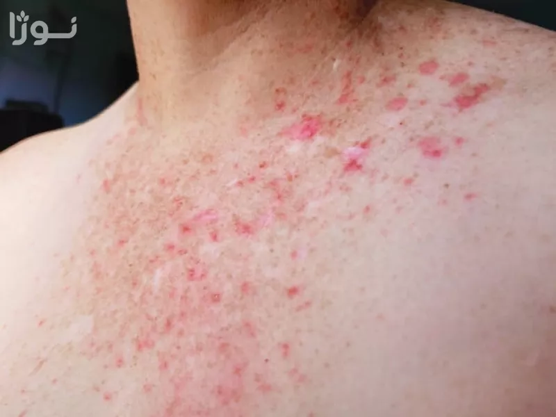 تصاویر وبلاگ خدمات نوژا سرویس
