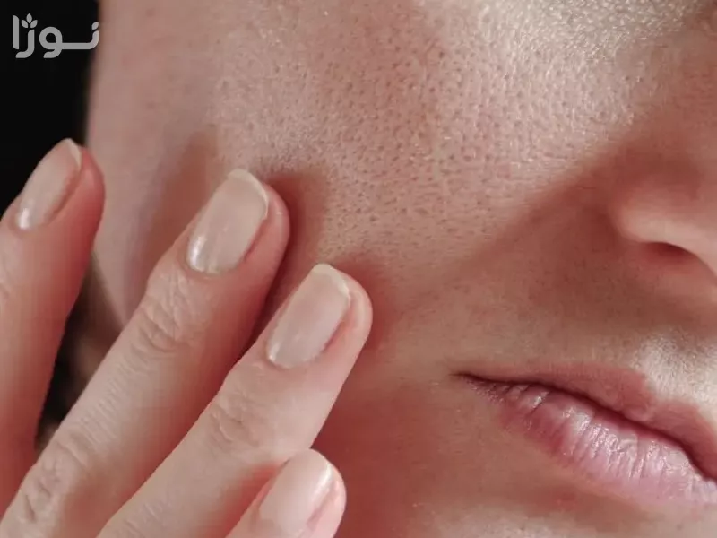 تصاویر وبلاگ خدمات نوژا سرویس