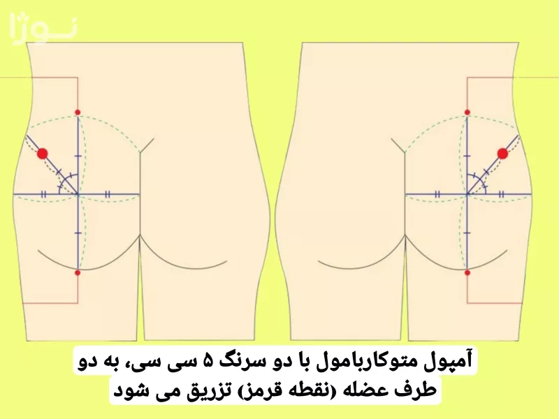تصاویر وبلاگ خدمات نوژا سرویس