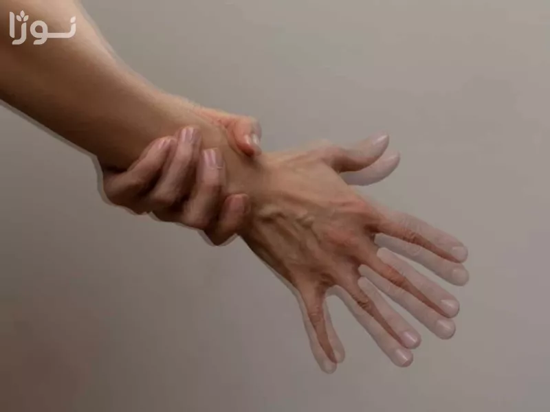 تصاویر وبلاگ خدمات نوژا سرویس