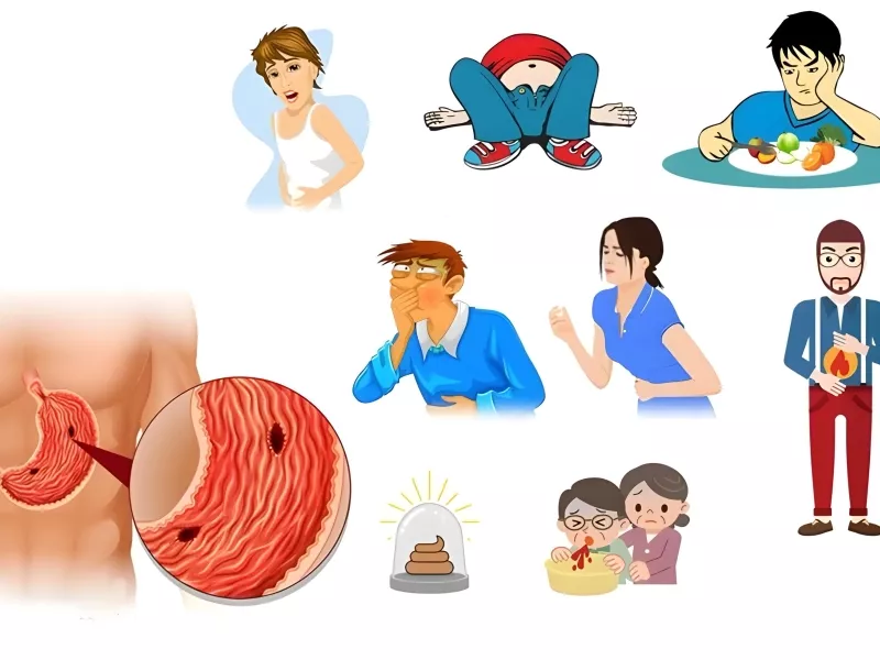 عوارض درمان نکردن زخم معده - خونریزی معده، سوراخ شدن معده و سرطان